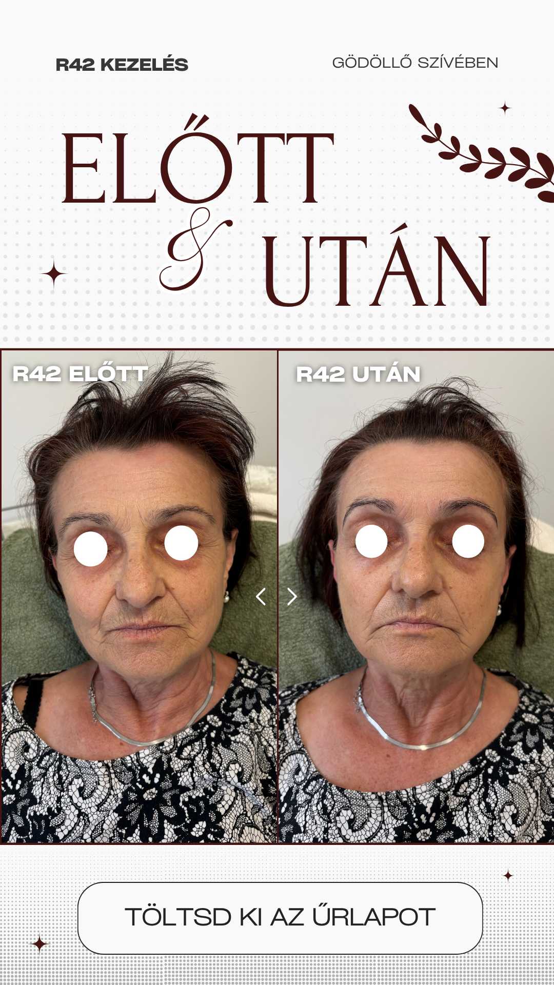 R42 kezelés előtte és utána